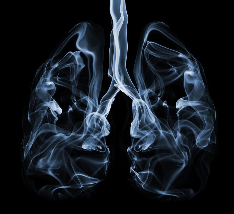 COPD/Emphysema