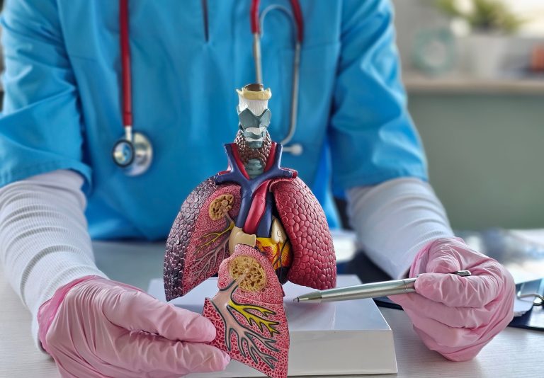 Lung Cancer & Pulmonary Nodules